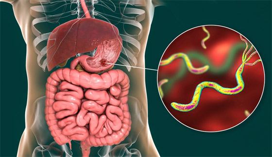 من بينها العرقسوس.. 5 مشروبات لعلاج قرحة المعدة وتلطيف الألم صورة رقم 8