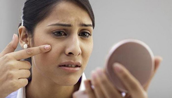 طرق لعلاج انسداد المسام.. شتاءً صورة رقم 2