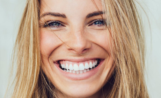 صورة رقم 3 - إليكم 5 طرق مدهشة لابتسامة هوليوودية دون تبييض الأسنان صورة رقم 3 - إليكم 5 طرق مدهشة لابتسامة هوليوودية دون تبييض الأسنان