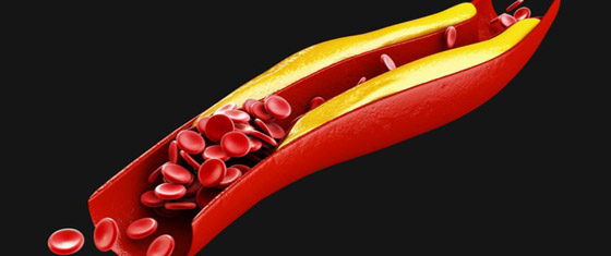 لمرضى الكولسترول فى رمضان.. 3 مشروبات تساعدك على خفض النسبة صورة رقم 6