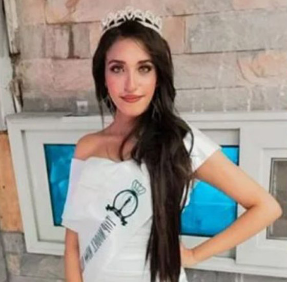 صورة رقم 6 - فيديو وصور مؤسفة: شاب يشوه وجه جارته ملكة الجمال المصرية بـ25 غرزة! صورة رقم 6 - فيديو وصور مؤسفة: شاب يشوه وجه جارته ملكة الجمال المصرية بـ25 غرزة!
