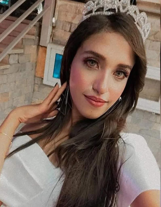 صورة رقم 2 - فيديو وصور مؤسفة: شاب يشوه وجه جارته ملكة الجمال المصرية بـ25 غرزة! صورة رقم 2 - فيديو وصور مؤسفة: شاب يشوه وجه جارته ملكة الجمال المصرية بـ25 غرزة!