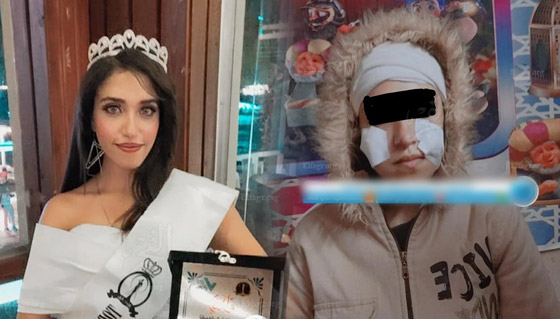 صورة رقم 1 - فيديو وصور مؤسفة: شاب يشوه وجه جارته ملكة الجمال المصرية بـ25 غرزة! صورة رقم 1 - فيديو وصور مؤسفة: شاب يشوه وجه جارته ملكة الجمال المصرية بـ25 غرزة!