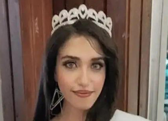 صورة رقم 7 - فيديو وصور مؤسفة: شاب يشوه وجه جارته ملكة الجمال المصرية بـ25 غرزة! صورة رقم 7 - فيديو وصور مؤسفة: شاب يشوه وجه جارته ملكة الجمال المصرية بـ25 غرزة!