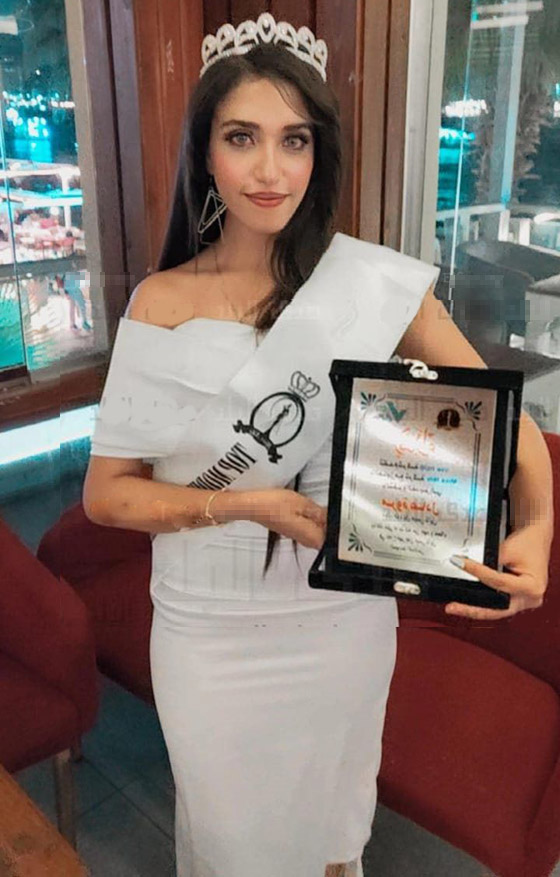 صورة رقم 4 - فيديو وصور مؤسفة: شاب يشوه وجه جارته ملكة الجمال المصرية بـ25 غرزة! صورة رقم 4 - فيديو وصور مؤسفة: شاب يشوه وجه جارته ملكة الجمال المصرية بـ25 غرزة!