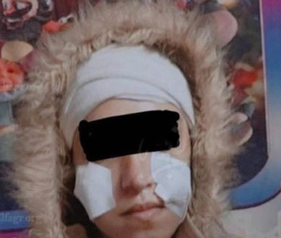 صورة رقم 5 - فيديو وصور مؤسفة: شاب يشوه وجه جارته ملكة الجمال المصرية بـ25 غرزة! صورة رقم 5 - فيديو وصور مؤسفة: شاب يشوه وجه جارته ملكة الجمال المصرية بـ25 غرزة!