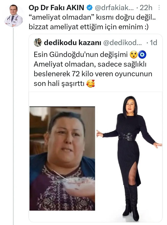 صورة رقم 2 - صور: نجمة تركية محرجة بعد أن كذبها طبيبها وفضحها! ادعت خسارة وزنها طبيعيا صورة رقم 2 - صور: نجمة تركية محرجة بعد أن كذبها طبيبها وفضحها! ادعت خسارة وزنها طبيعيا