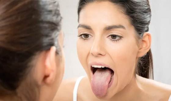 لسانك مرآة صحتك العامة.. إليك الأسباب والأعراض لوجود مشاكل صورة رقم 2
