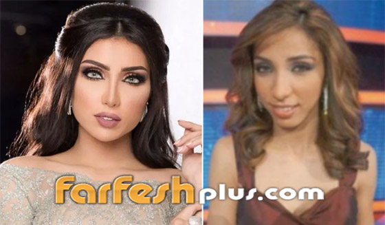 صورة رقم 1 - صور نجمات عربيات قبل وبعد عمليات التجميل بينهن أصالة وياسمين صبري! هل تبدلت ملامحهن؟ صورة رقم 1 - صور نجمات عربيات قبل وبعد عمليات التجميل بينهن أصالة وياسمين صبري! هل تبدلت ملامحهن؟