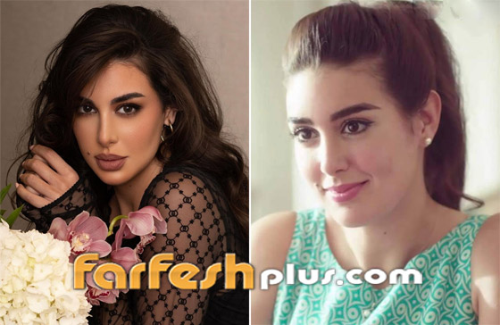 صورة رقم 2 - صور نجمات عربيات قبل وبعد عمليات التجميل بينهن أصالة وياسمين صبري! هل تبدلت ملامحهن؟ صورة رقم 2 - صور نجمات عربيات قبل وبعد عمليات التجميل بينهن أصالة وياسمين صبري! هل تبدلت ملامحهن؟