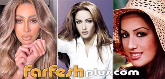 صورة رقم 3 - صور نجمات عربيات قبل وبعد عمليات التجميل بينهن أصالة وياسمين صبري! هل تبدلت ملامحهن؟ صورة رقم 3 - صور نجمات عربيات قبل وبعد عمليات التجميل بينهن أصالة وياسمين صبري! هل تبدلت ملامحهن؟