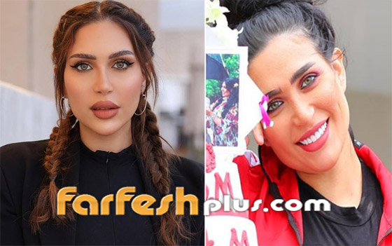 صورة رقم 6 - صور نجمات عربيات قبل وبعد عمليات التجميل بينهن أصالة وياسمين صبري! هل تبدلت ملامحهن؟ صورة رقم 6 - صور نجمات عربيات قبل وبعد عمليات التجميل بينهن أصالة وياسمين صبري! هل تبدلت ملامحهن؟