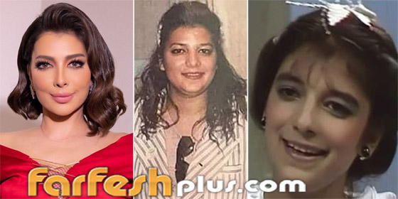 صورة رقم 7 - صور نجمات عربيات قبل وبعد عمليات التجميل بينهن أصالة وياسمين صبري! هل تبدلت ملامحهن؟ صورة رقم 7 - صور نجمات عربيات قبل وبعد عمليات التجميل بينهن أصالة وياسمين صبري! هل تبدلت ملامحهن؟