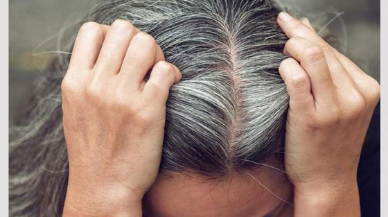 هل هناك علاج حقيقي لشيب الشعر؟.. إليك الإجابة صورة رقم 2