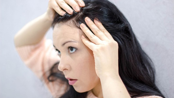 هل هناك علاج حقيقي لشيب الشعر؟.. إليك الإجابة صورة رقم 3