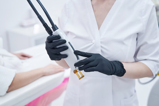 إزالة الشعر بالليزر.. كل ما تحتاجين إلى معرفته صورة رقم 4