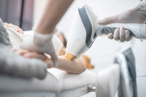 إزالة الشعر بالليزر.. كل ما تحتاجين إلى معرفته صورة رقم 5