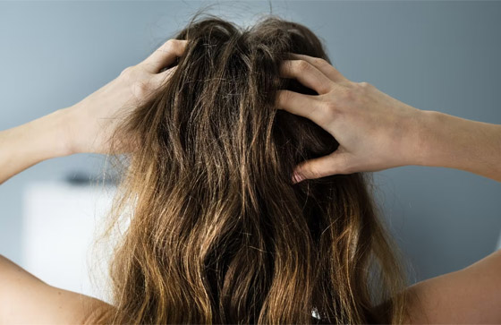 من بينها تدليك فروة الرأس.. نصائح سهلة للحصول على شعر صحي صورة رقم 3 من بينها تدليك فروة الرأس.. نصائح سهلة للحصول على شعر صحي صورة رقم 3