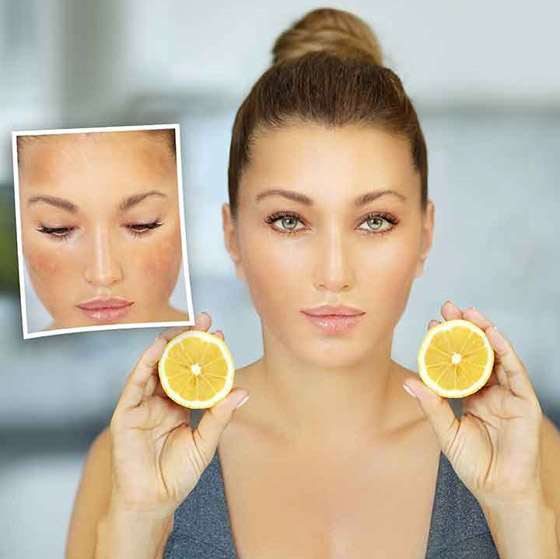 هذه أغرب المكونات المزيلة للبقع الداكنة.. هل تعرفونها؟ صورة رقم 4