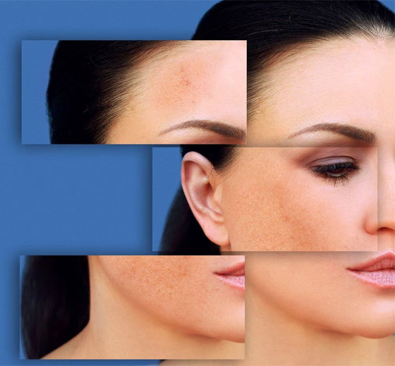 هذه أغرب المكونات المزيلة للبقع الداكنة.. هل تعرفونها؟ صورة رقم 5