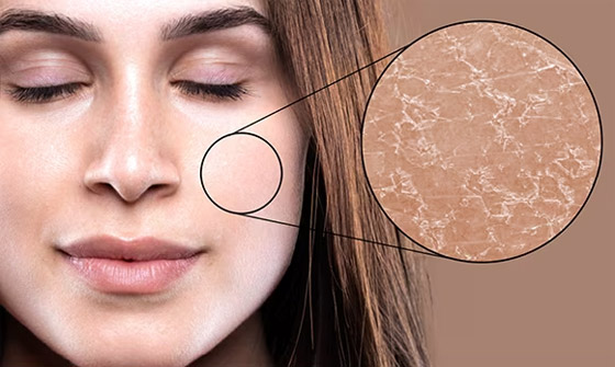 ما هو التأثير الحقيقي لارتفاع حرارة الطقس على البشرة؟ صورة رقم 2