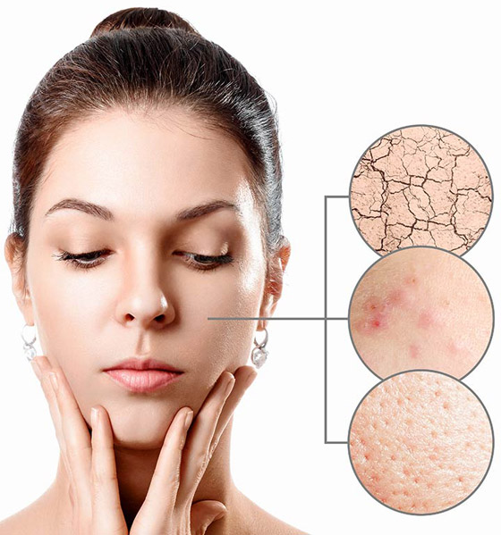 هذه أسباب ظهور البثور على البشرة الجافة.. إليكم الحل صورة رقم 2 هذه أسباب ظهور البثور على البشرة الجافة.. إليكم الحل صورة رقم 2