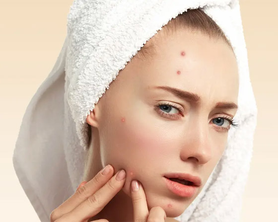 هذه أسباب ظهور البثور على البشرة الجافة.. إليكم الحل صورة رقم 1 هذه أسباب ظهور البثور على البشرة الجافة.. إليكم الحل صورة رقم 1