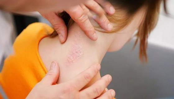 لمن يعانون هذا المرض.. احذروا نقص فيتامين 