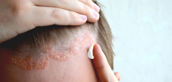 لمن يعانون هذا المرض.. احذروا نقص فيتامين 