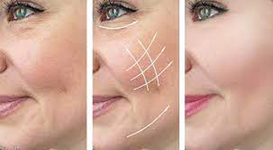 ترهل الجلد.. عالجيه في المنزل بهذه الطرق صورة رقم 7