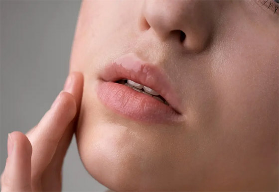 ما هي أسباب ظهور حب الشباب على منطقة الذقن؟ صورة رقم 5 ما هي أسباب ظهور حب الشباب على منطقة الذقن؟ صورة رقم 5