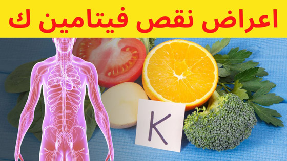 أعراض نقص فيتامين ك.. 7 علامات تحتاج إلى مراقبتها صورة رقم 3