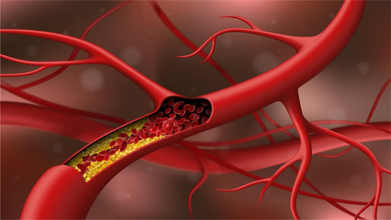 صورة رقم 5 - إليكم أطعمة تساهم في تقليل نسبة الكوليسترول بالدم.. أهمها الفشار صورة رقم 5 - إليكم أطعمة تساهم في تقليل نسبة الكوليسترول بالدم.. أهمها الفشار