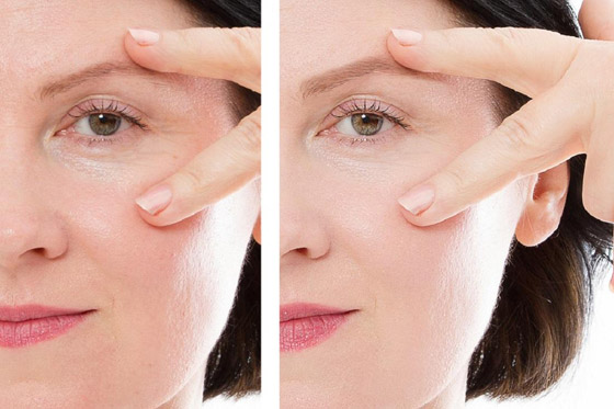 صورة رقم 6 - 5 طرق مميزة لعلاج كافة مشاكل البشرة ومحاربة التجاعيد صورة رقم 6 - 5 طرق مميزة لعلاج كافة مشاكل البشرة ومحاربة التجاعيد