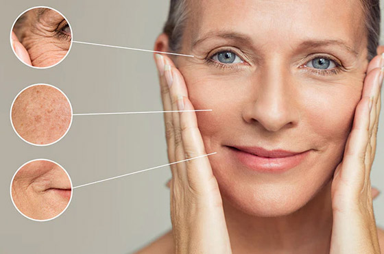 صورة رقم 10 - 5 طرق مميزة لعلاج كافة مشاكل البشرة ومحاربة التجاعيد صورة رقم 10 - 5 طرق مميزة لعلاج كافة مشاكل البشرة ومحاربة التجاعيد