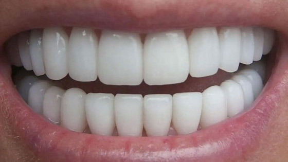    3 -     ..     