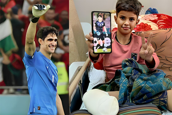 صورة رقم 1 - ياسين بونو حارس منتخب المغرب يحقق حلم طفل فلسطيني بُترت قدمه صورة رقم 1 - ياسين بونو حارس منتخب المغرب يحقق حلم طفل فلسطيني بُترت قدمه