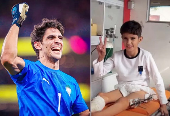 صورة رقم 2 - ياسين بونو حارس منتخب المغرب يحقق حلم طفل فلسطيني بُترت قدمه صورة رقم 2 - ياسين بونو حارس منتخب المغرب يحقق حلم طفل فلسطيني بُترت قدمه