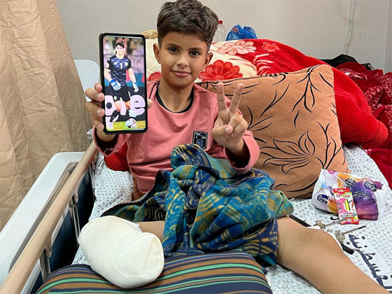صورة رقم 4 - ياسين بونو حارس منتخب المغرب يحقق حلم طفل فلسطيني بُترت قدمه صورة رقم 4 - ياسين بونو حارس منتخب المغرب يحقق حلم طفل فلسطيني بُترت قدمه