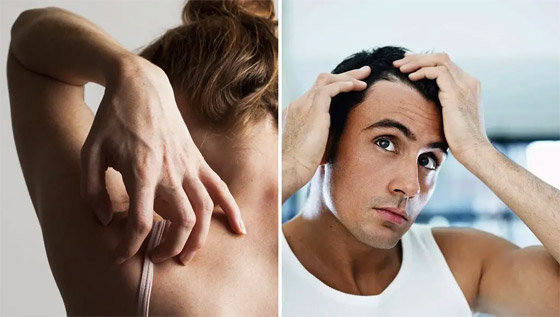 صورة رقم 1 - 6 علامات تشير إلى وجود أمراض خطيرة وراء تساقط الشعر صورة رقم 1 - 6 علامات تشير إلى وجود أمراض خطيرة وراء تساقط الشعر