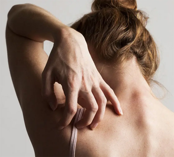 صورة رقم 7 - 6 علامات تشير إلى وجود أمراض خطيرة وراء تساقط الشعر صورة رقم 7 - 6 علامات تشير إلى وجود أمراض خطيرة وراء تساقط الشعر