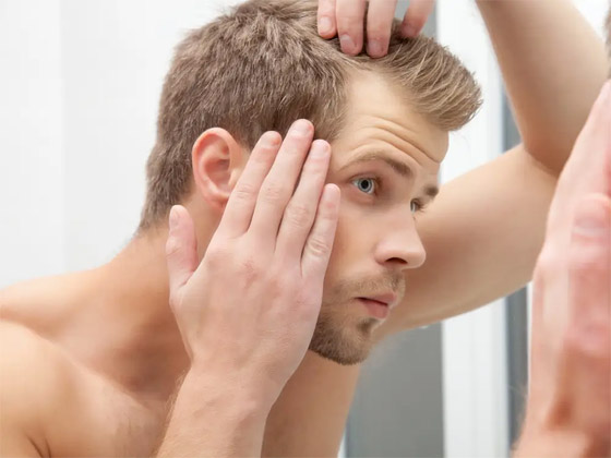 صورة رقم 9 - 6 علامات تشير إلى وجود أمراض خطيرة وراء تساقط الشعر صورة رقم 9 - 6 علامات تشير إلى وجود أمراض خطيرة وراء تساقط الشعر