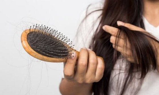 احذري أنواع الشامبو هذه.. 3 مكونات تزيد تساقط الشعر صورة رقم 5