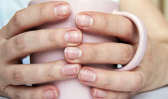 من لون أظافرك.. يمكنك التعرف على حالتك الصحية صورة رقم 1