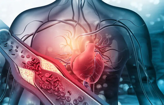 استثمر في صحة عضلاتك لعمر أطول.. إليك أفضل 3 طرق صورة رقم 2