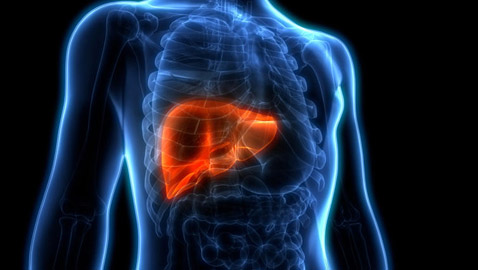 أعراض مرض الكبد الدهني: 6 علامات شائعة لتليّف الكبد!