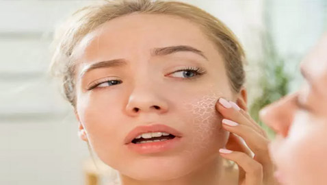 إليكم خطوات ونصائح بسيطة لتعويض جفاف البشرة وعلاجه مع الصيام