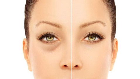 نصائح للحد من مشكلة الأكياس تحت العين!