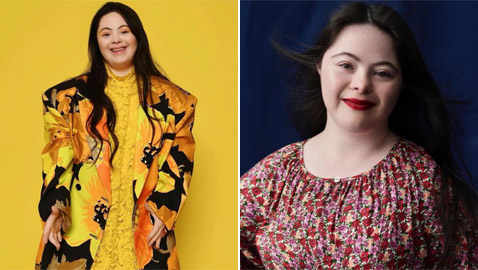 صور: شابة مصابة بمتلازمة داون (المنغولية) تصبح عارضة لـ غوتشي