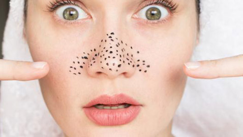 اليك طرق سهلة ومثالية للتخلص من الرؤوس السوداء في ثلاثة أيام